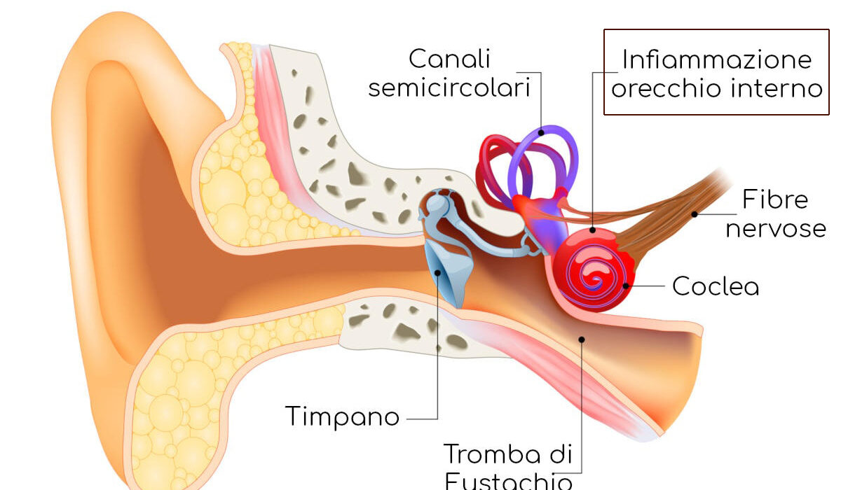 orecchio interno infiammato