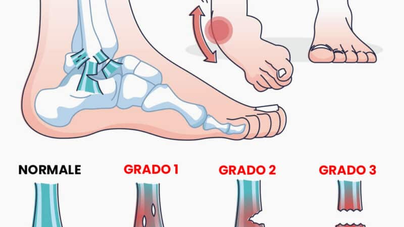 i tre gradi di distorsione